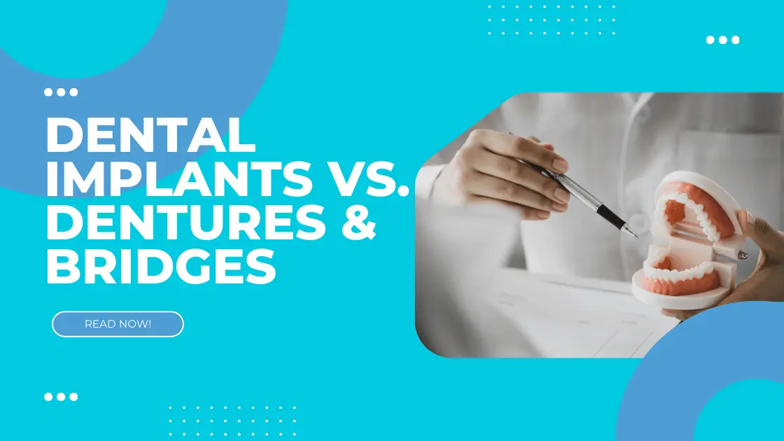 Dental Implants vs. Dentures & Bridges