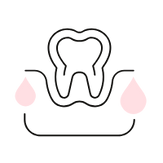 Bleeding Gums