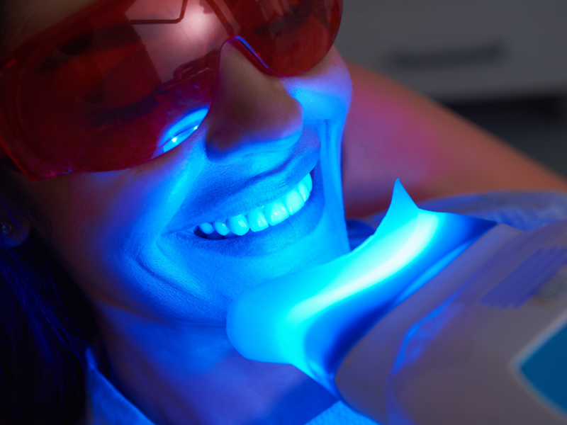Cosmetic Dentistry - Teeth Whitening Procedure - Plaza Dental Specialty Group