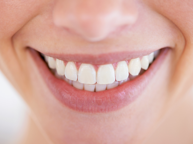 Dental Implants - Plaza Dental Specialty Group