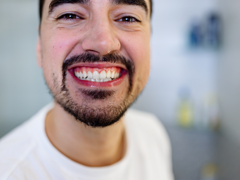 Dental Implants in Gardena - Plaza Dental Specialty Group