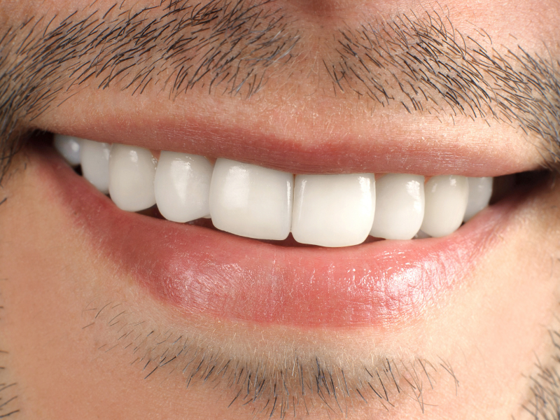 Dental Implants in Los Angeles- Plaza Dental Specialty Group