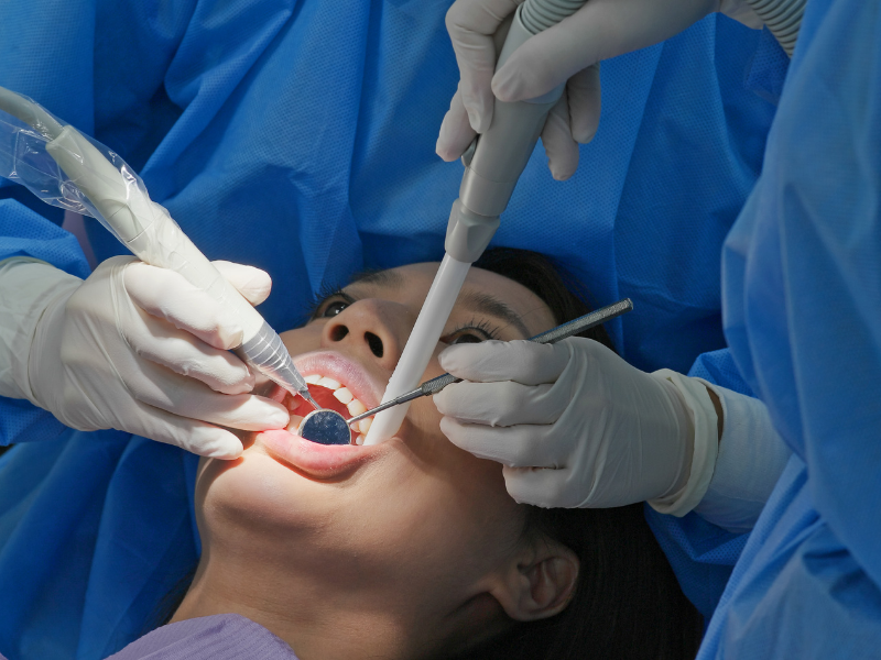 Periodontal Treatment - Dental Scaling Being Performed on Patient - Plaza Dental Specialty Group
