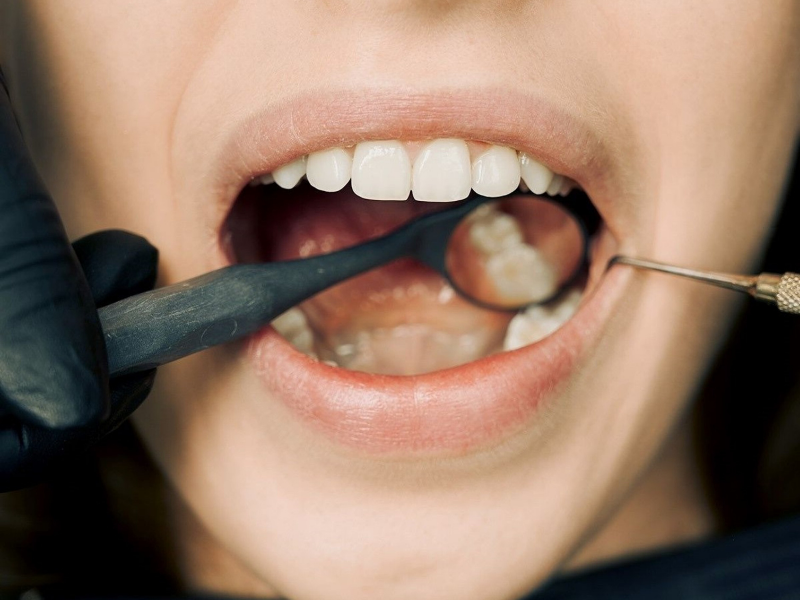 Periodontal Treatment - Examination Being Done Before Procedure - Plaza Dental Specialty Group
