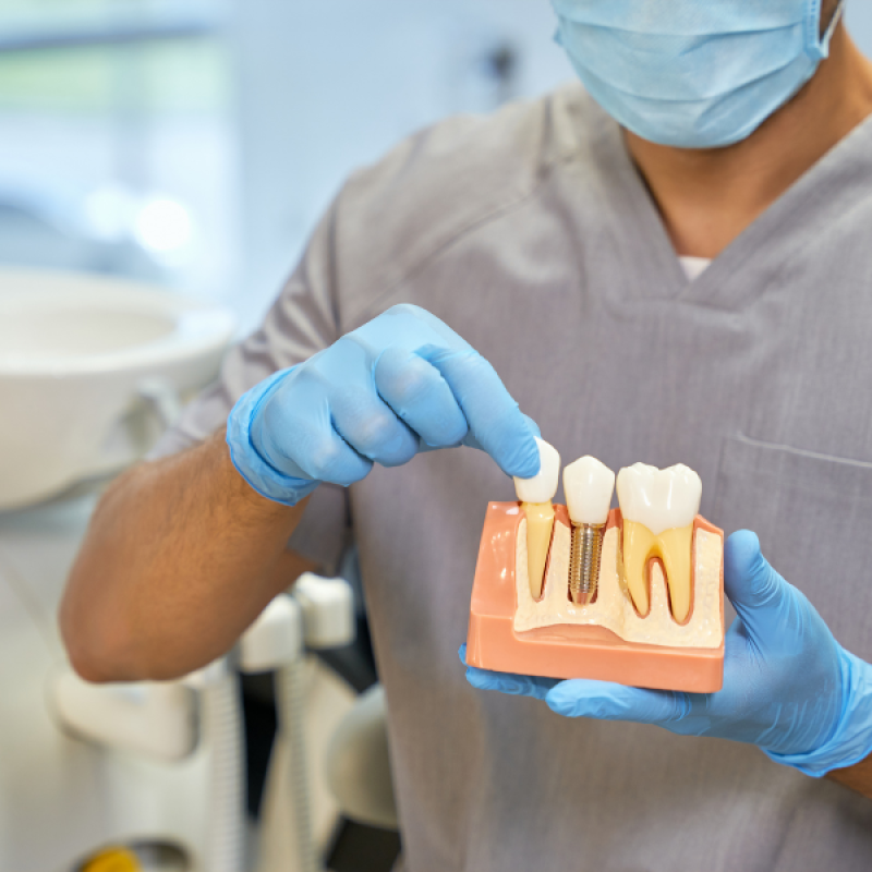 Which Dental Implant Option Is Right for You? Your Guide to a Confident Smile in Gardena
